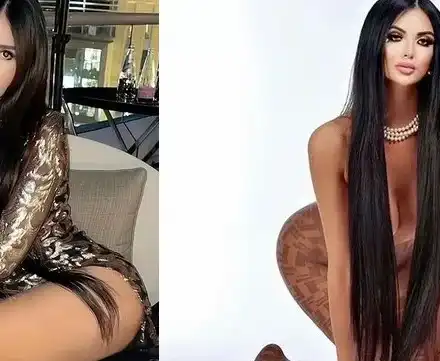 500 пъти си опъва лицето новата Ким Кардашиян