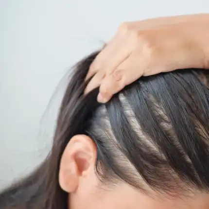 Как да възстановим нормалните обем и дължина на косата ни?