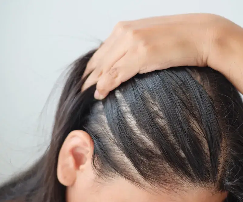 Как да възстановим нормалните обем и дължина на косата ни?