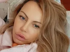 Камелия обезобрази и устните си