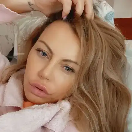 Камелия обезобрази и устните си