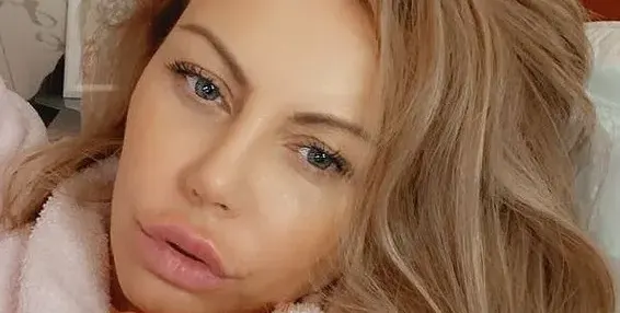 Камелия обезобрази и устните си