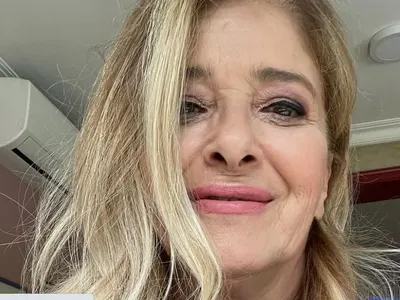 Катето Евро опъна бръчки на 64! (СНИМКИ преди и след)