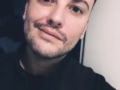 Стефан Илчев се наблъска с хиалурон