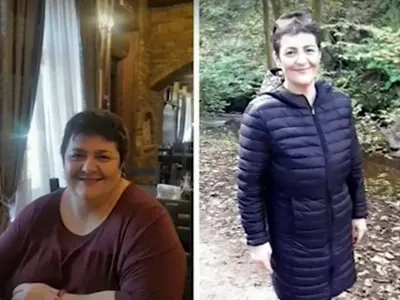 Жена отслабна със 100 кг! Тони Йорданова влезе във форма с хирургична операция