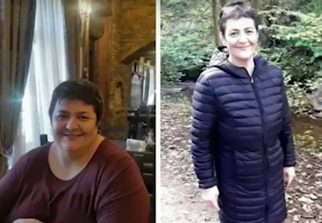 Жена отслабна със 100 кг! Тони Йорданова влезе във форма с хирургична операция