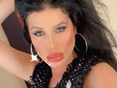 Мис България Радинела Чушева с нов нос! Бившата адреналинка пак подразни феновете си - ФОТО