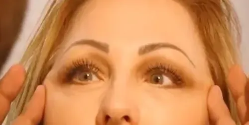 Рени опъва бръчки с лифтинг (Фото)