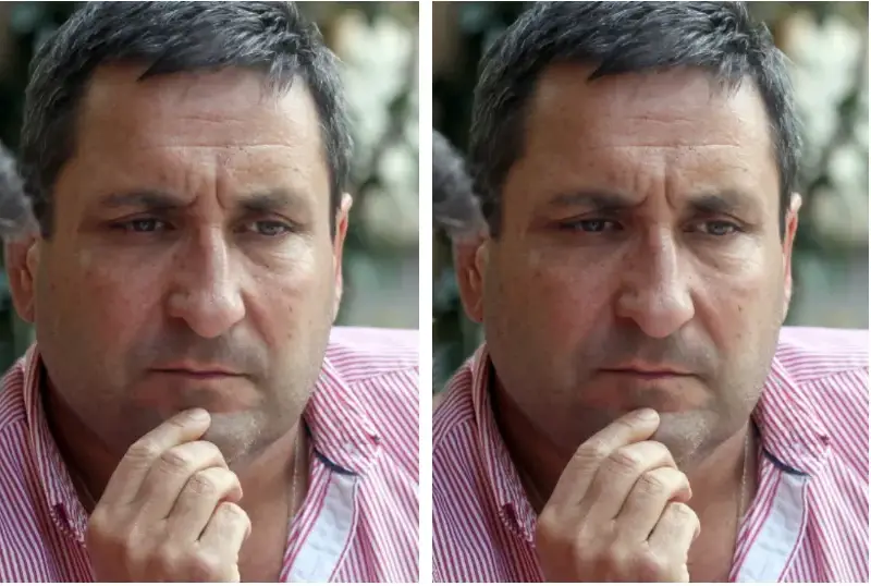 Тончо Токмакчиев махна бенката на лицето си