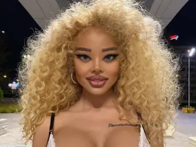 Плеймейтката Мартина Юрукова се обезобрази до неузнаваемост