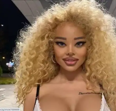 Плеймейтката Мартина Юрукова се обезобрази до неузнаваемост