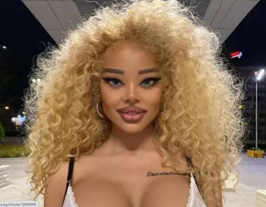 Плеймейтката Мартина Юрукова се обезобрази до неузнаваемост