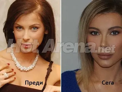 ШОК: Бившата метреса на Вальо Топлото - Елена Тихомирова смени лицето си