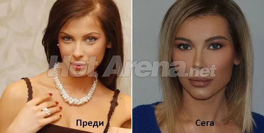 ШОК: Бившата метреса на Вальо Топлото - Елена Тихомирова смени лицето си
