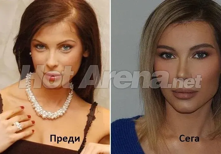 ШОК: Бившата метреса на Вальо Топлото - Елена Тихомирова смени лицето си