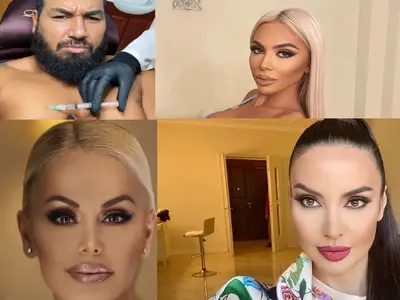 Родният хайлайф полудя по естетичните процедури (Ето кои звезди най-често се разкрасяват)