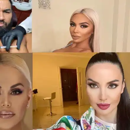 Родният хайлайф полудя по естетичните процедури (Ето кои звезди най-често се разкрасяват)