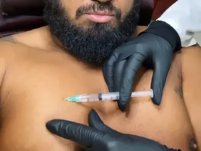 Родният хайлайф полудя по естетичните процедури (Ето кои звезди най-често се разкрасяват)