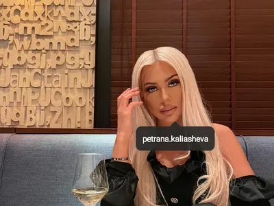 Родният хайлайф полудя по естетичните процедури (Ето кои звезди най-често се разкрасяват)