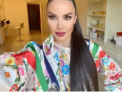 Родният хайлайф полудя по естетичните процедури (Ето кои звезди най-често се разкрасяват)