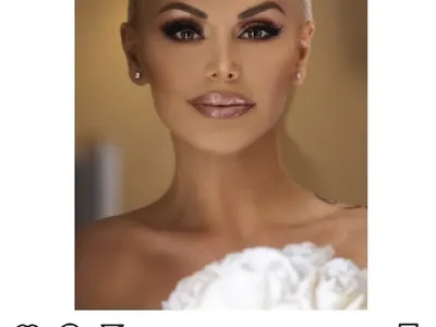 Родният хайлайф полудя по естетичните процедури (Ето кои звезди най-често се разкрасяват)