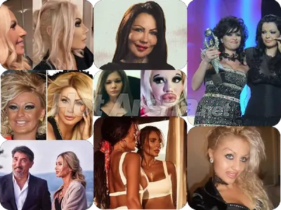 Звездна касапница: Родни красавици се обезобразиха и смениха лицата си, при някои има положителен ефект  (Снимки)