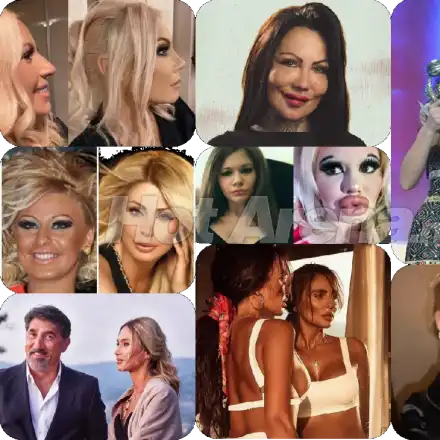 Звездна касапница: Родни красавици се обезобразиха и смениха лицата си, при някои има положителен ефект  (Снимки)