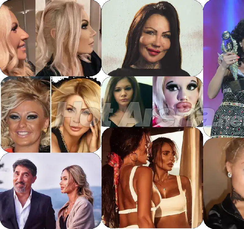 Звездна касапница: Родни красавици се обезобразиха и смениха лицата си, при някои има положителен ефект  (Снимки)