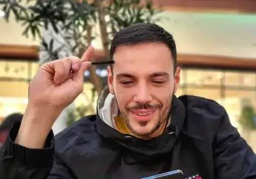 Даниел Петканов си сложи имплант и в брадичката