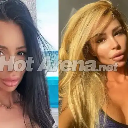 Фотосесията си смени лицето с 4 операции