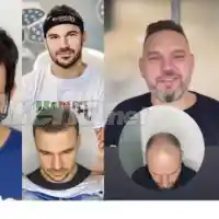 Лабораторна растителност краси главите на над 10 над популярни българи