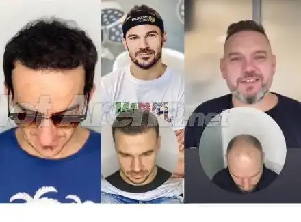 Лабораторна растителност краси главите на над 10 над популярни българи