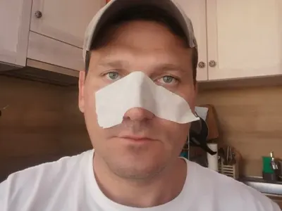 Митко Павлов подигра Петканови заради операцията на носовете