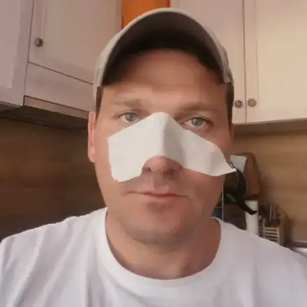 Митко Павлов подигра Петканови заради операцията на носовете