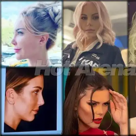 Новата болест! Родни звезди масово си режат носовете! Вижте коя е рекордьорката по пластики! (СНИМКИ)