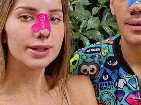 Петканови отчаяни, не харесват новите си носове