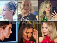 Новата болест! Родни звезди масово си режат носовете! Вижте коя е рекордьорката по пластики! (СНИМКИ)