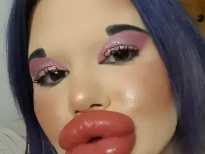 Поредна процедура! БГ Барбито си удължава лицето! (СНИМКИ)