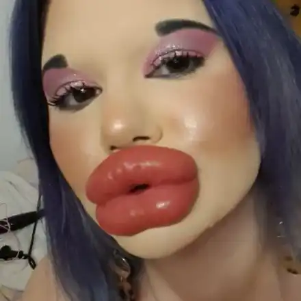 Поредна процедура! БГ Барбито си удължава лицето! (СНИМКИ)