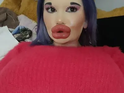 Поредна процедура! БГ Барбито си удължава лицето! (СНИМКИ)