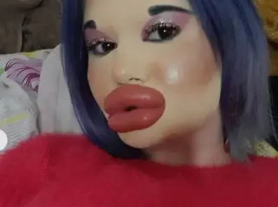 Поредна процедура! БГ Барбито си удължава лицето! (СНИМКИ)