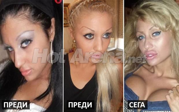 Ужасяващи резултати след серия корекции: Адриана стана Мис Пиги, БГ Барби плаши и още… (Снимки)