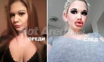 Ужасяващи резултати след серия корекции: Адриана стана Мис Пиги, БГ Барби плаши и още… (Снимки)