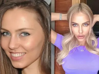 Жасмина от  „Сделка или не“  се обезорази от пластики