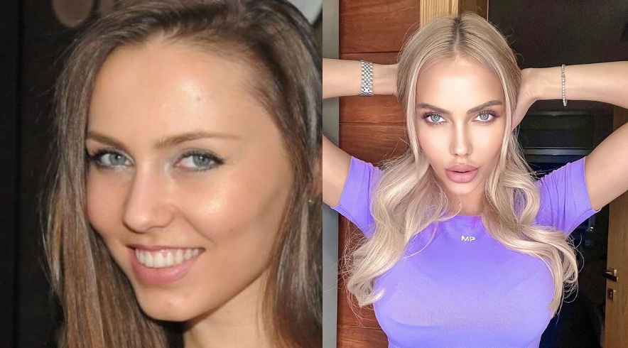 Жасмина от  „Сделка или не“  се обезорази от пластики