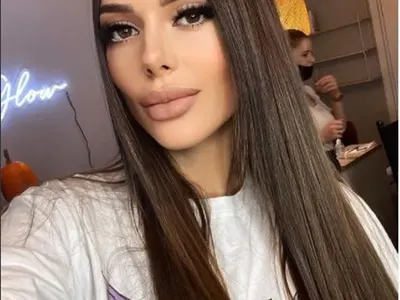 Снахата на Доган си клъцна носа в Истанбул