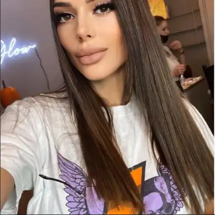 Снахата на Доган си клъцна носа в Истанбул