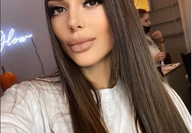 Снахата на Доган си клъцна носа в Истанбул