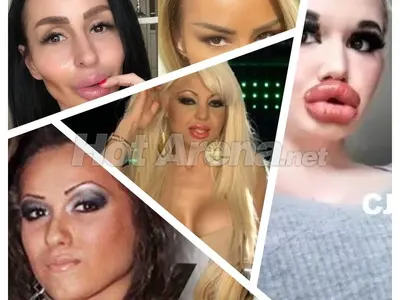 Ужасяващи резултати след серия корекции: Адриана стана Мис Пиги, БГ Барби плаши и още… (Снимки)