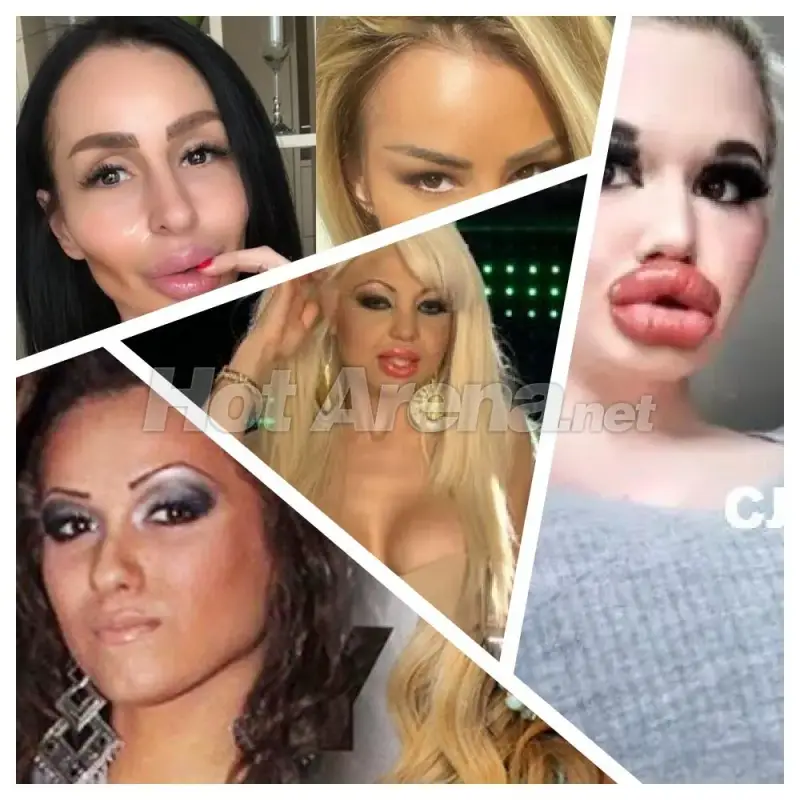 Ужасяващи резултати след серия корекции: Адриана стана Мис Пиги, БГ Барби плаши и още… (Снимки)